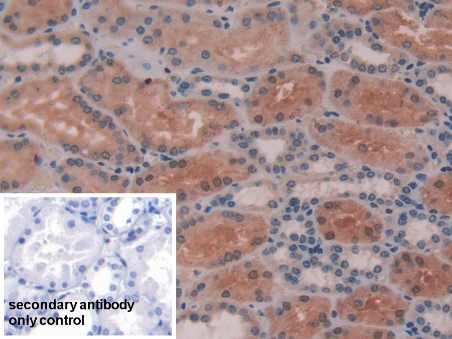 Polyclonal Antibody to Alanine Aminotransferase (ALT)