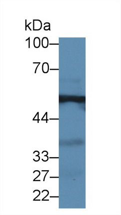 Polyclonal Antibody to Alanine Aminotransferase (ALT)