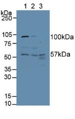 Polyclonal Antibody to Alanine Aminotransferase (ALT)