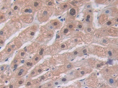 Polyclonal Antibody to Alanine Aminotransferase (ALT)