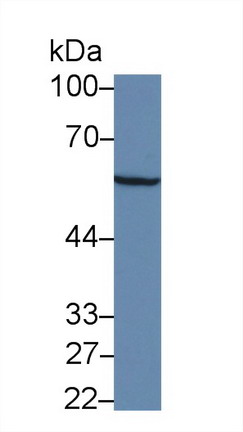 Polyclonal Antibody to Alanine Aminotransferase (ALT)