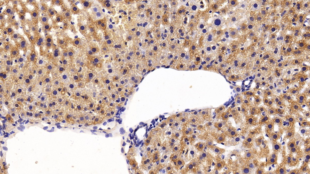 Polyclonal Antibody to Alanine Aminotransferase (ALT)