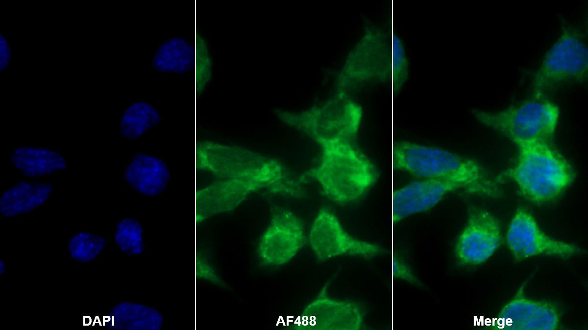 Polyclonal Antibody to Alanine Aminotransferase (ALT)