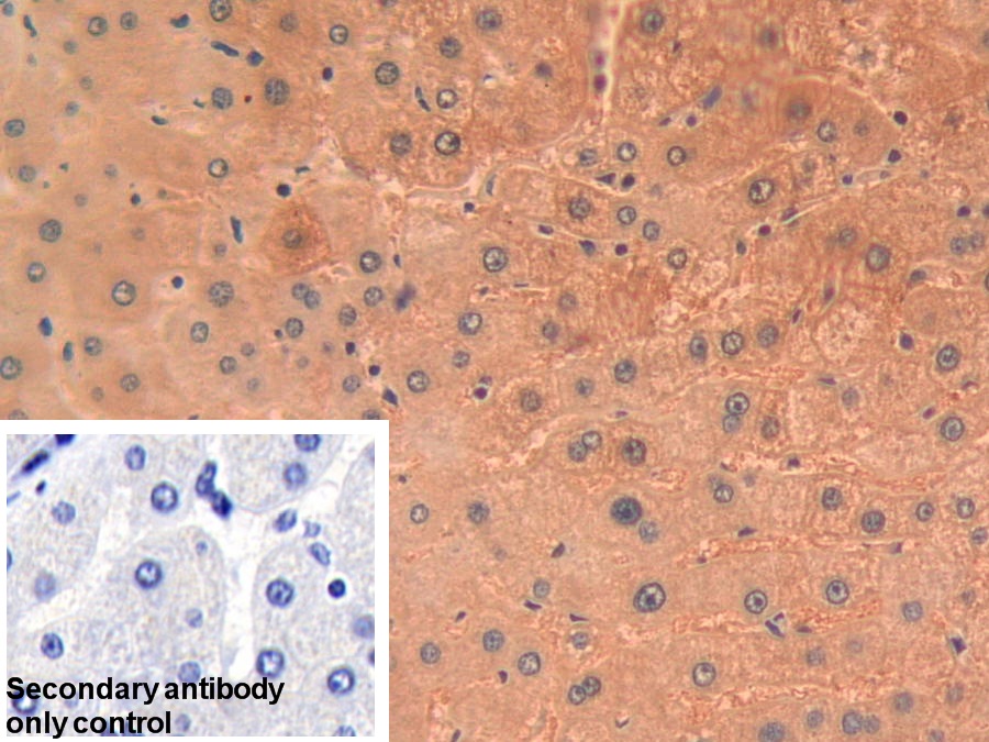 Polyclonal Antibody to Pyruvate kinase isozymes R/L (PKLR)