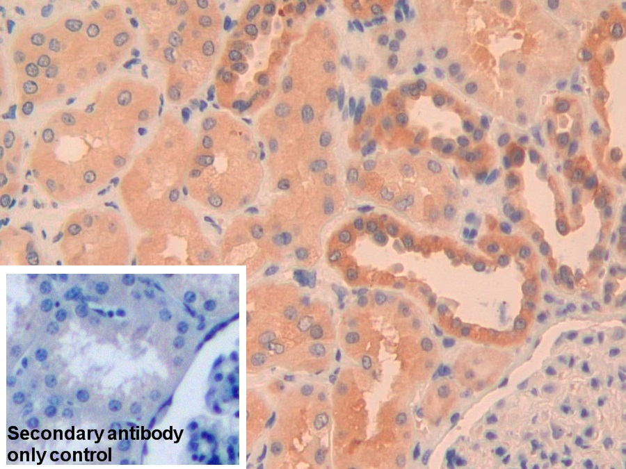 Polyclonal Antibody to Pyruvate kinase isozymes R/L (PKLR)