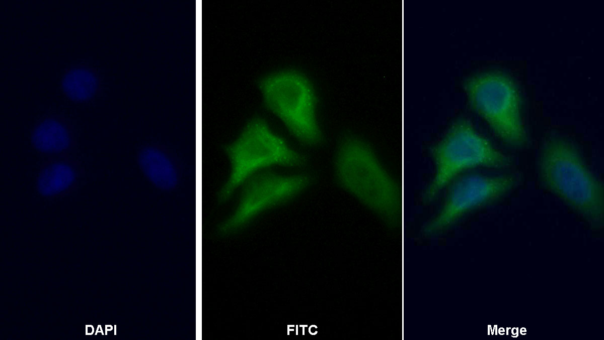 Polyclonal Antibody to Pyruvate kinase isozymes R/L (PKLR)