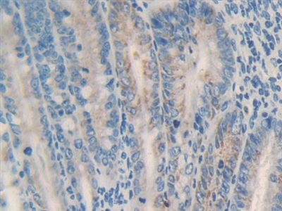 Polyclonal Antibody to Matrix Metalloproteinase 23A (MMP23A)