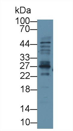 Polyclonal Antibody to Triggering Receptor Expressed On Myeloid Cells 1 (TREM1)