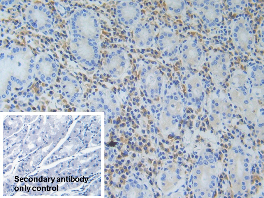 Polyclonal Antibody to Triggering Receptor Expressed On Myeloid Cells 1 (TREM1)