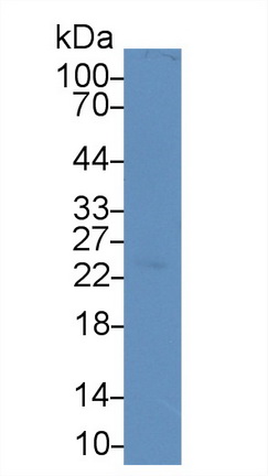 Polyclonal Antibody to Triggering Receptor Expressed On Myeloid Cells 1 (TREM1)