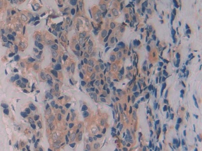 Polyclonal Antibody to Caveolin 1 (CAV1)