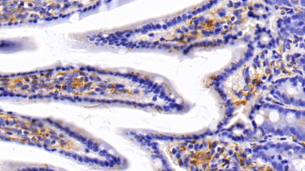 Polyclonal Antibody to Caveolin 1 (CAV1)