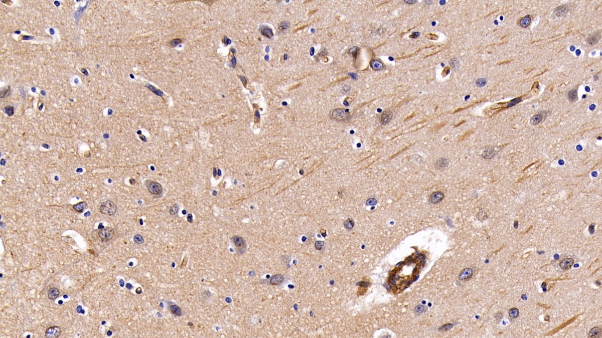 Polyclonal Antibody to Caveolin 1 (CAV1)