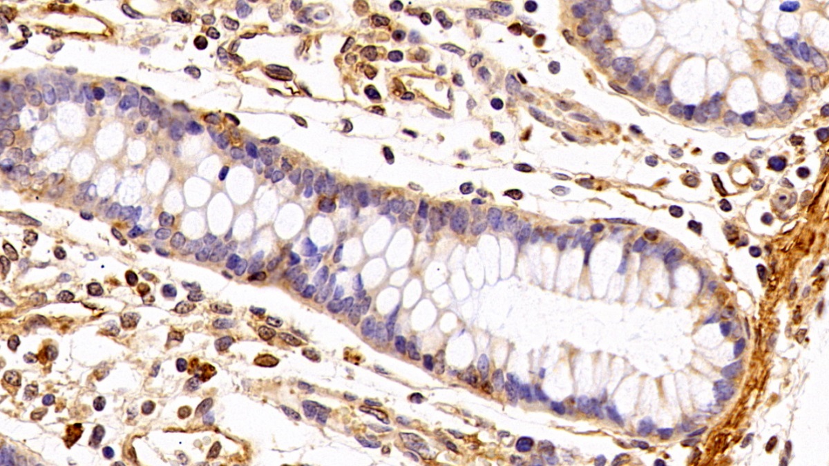 Polyclonal Antibody to Caveolin 1 (CAV1)