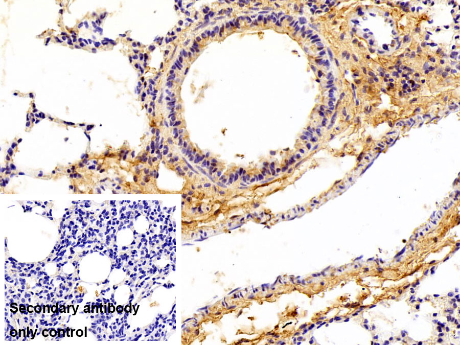 Polyclonal Antibody to Collagen Type I Alpha 2 (COL1a2)