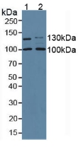 Polyclonal Antibody to Collagen Type I Alpha 2 (COL1a2)