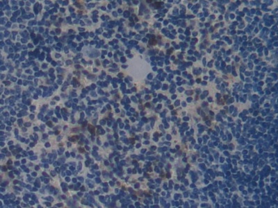 Polyclonal Antibody to Collagen Type I Alpha 2 (COL1a2)