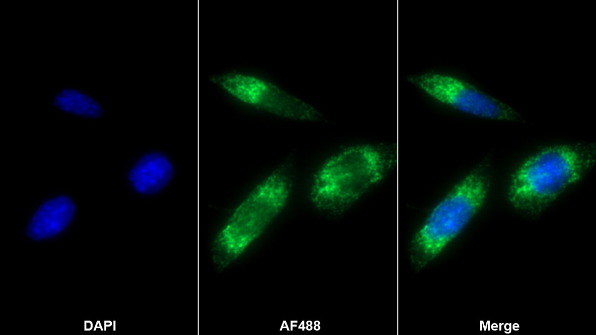 Polyclonal Antibody to Collagen Type I Alpha 2 (COL1a2)