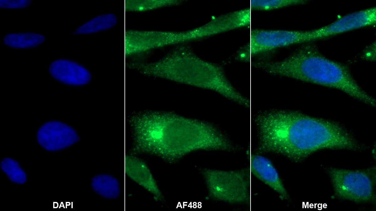 Polyclonal Antibody to Monocyte Chemotactic Protein 4 (MCP4)