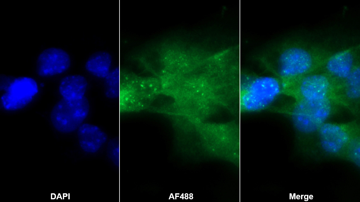 Polyclonal Antibody to Alpha-1-Microglobulin (a1M)