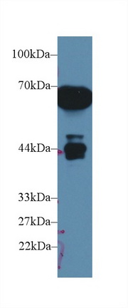 Polyclonal Antibody to Alpha-1-Microglobulin (a1M)