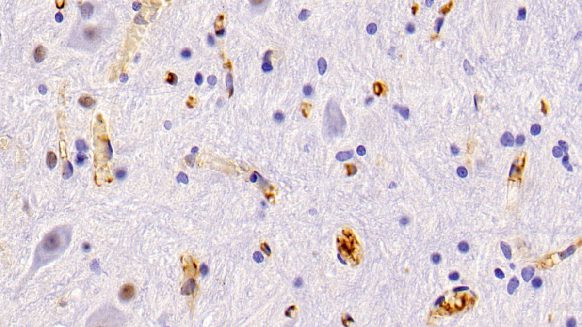 Polyclonal Antibody to Alpha-1-Microglobulin (a1M)