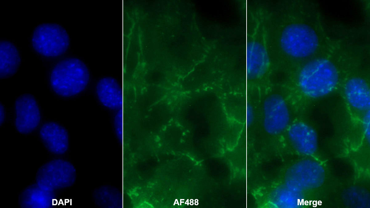 Polyclonal Antibody to Alpha-1-Microglobulin (a1M)