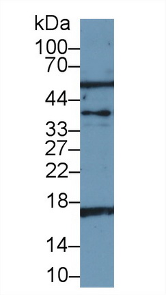 Polyclonal Antibody to Adrenomedullin (ADM)