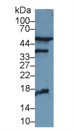 Polyclonal Antibody to Adrenomedullin (ADM)