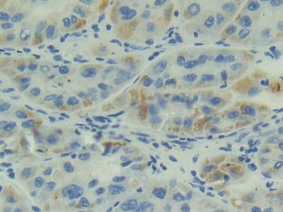 Polyclonal Antibody to Adrenomedullin (ADM)