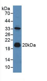 Polyclonal Antibody to Adrenomedullin (ADM)