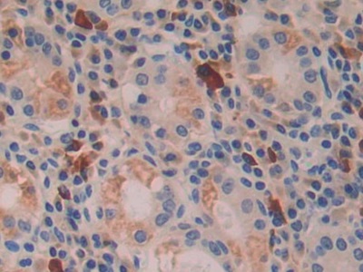 Polyclonal Antibody to Interferon Beta (IFNb)