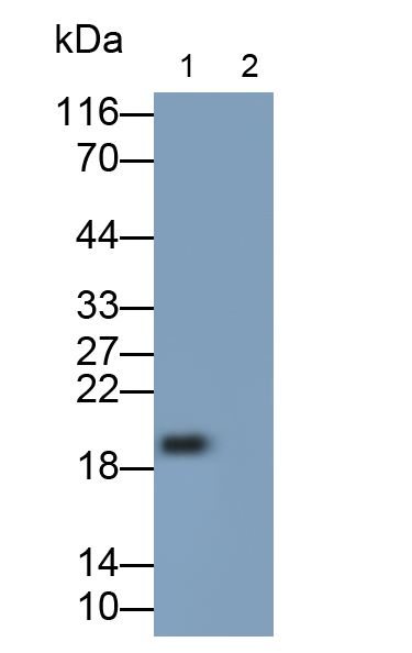 Polyclonal Antibody to Interferon Beta (IFNb)