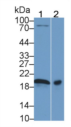 Polyclonal Antibody to Interleukin 1 Receptor Antagonist (IL1RA)