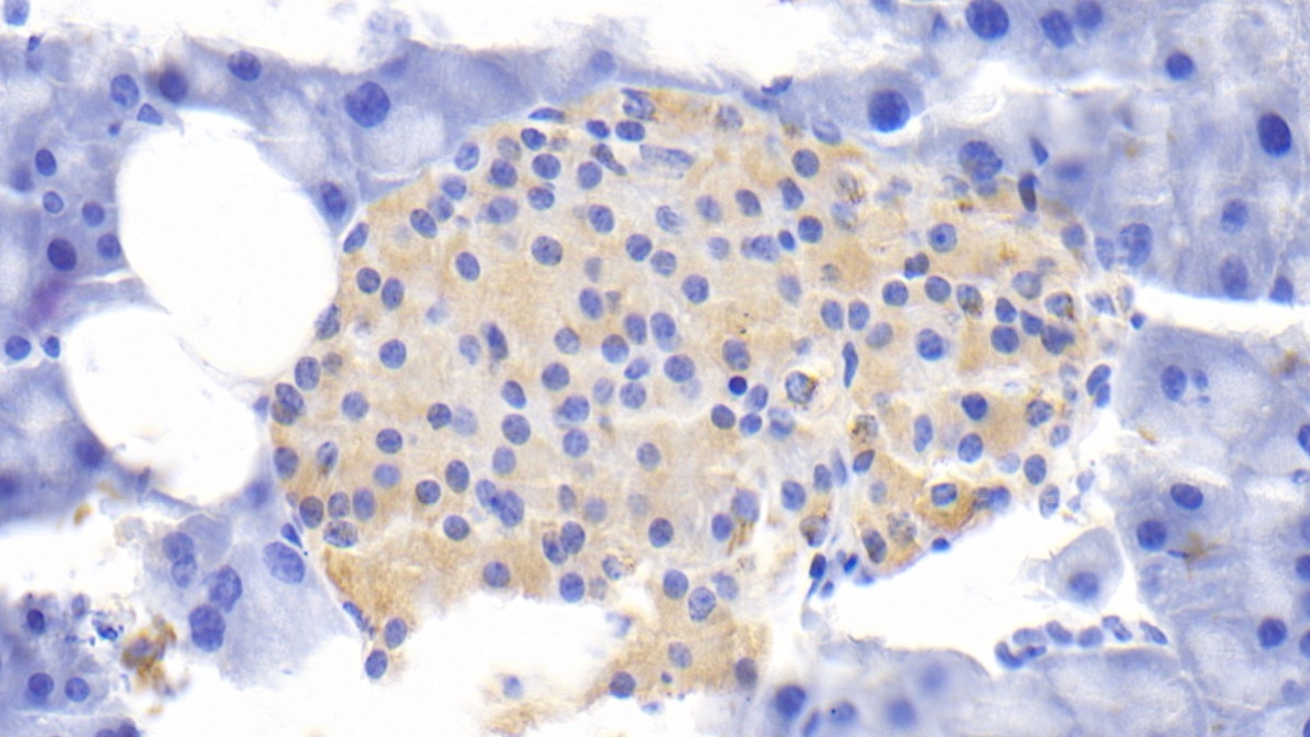 Polyclonal Antibody to Interleukin 1 Receptor Antagonist (IL1RA)