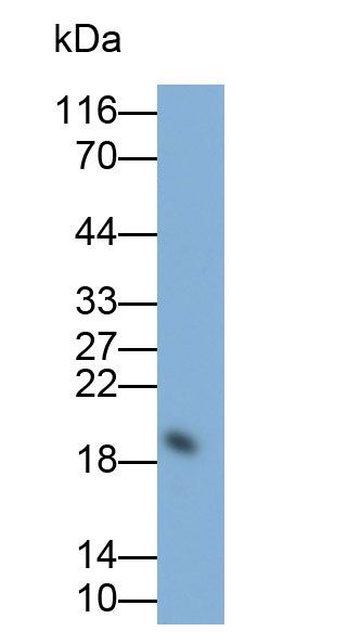 Polyclonal Antibody to Interleukin 1 Receptor Antagonist (IL1RA)