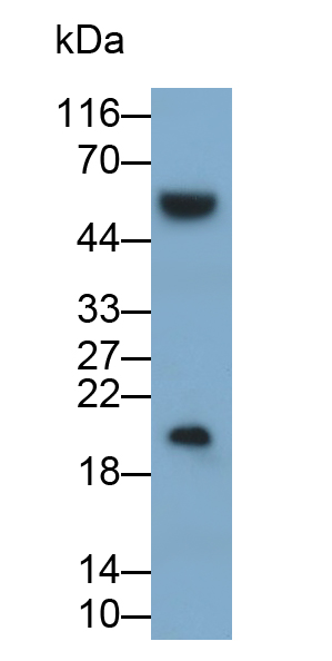 Polyclonal Antibody to Interleukin 1 Receptor Antagonist (IL1RA)