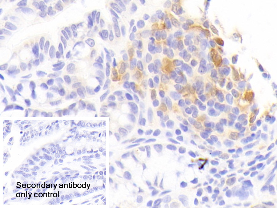 Polyclonal Antibody to Interleukin 1 Receptor Antagonist (IL1RA)