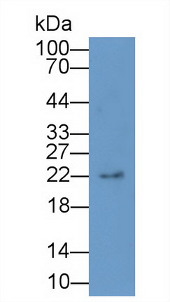 Polyclonal Antibody to Interleukin 1 Receptor Antagonist (IL1RA)