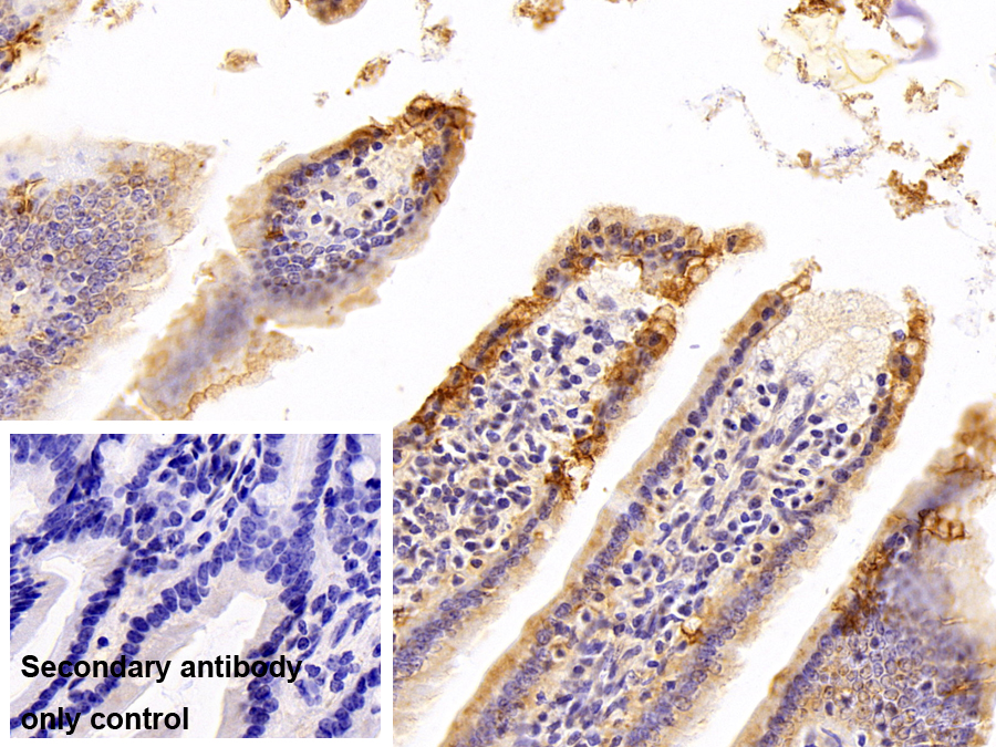 Polyclonal Antibody to Free Fatty Acid Receptor 3 (FFAR3)