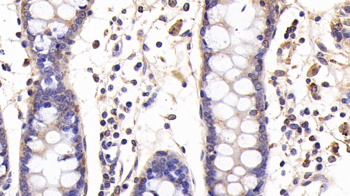 Polyclonal Antibody to Cyclophilin B (CYPB)