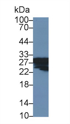 Polyclonal Antibody to Cyclophilin B (CYPB)