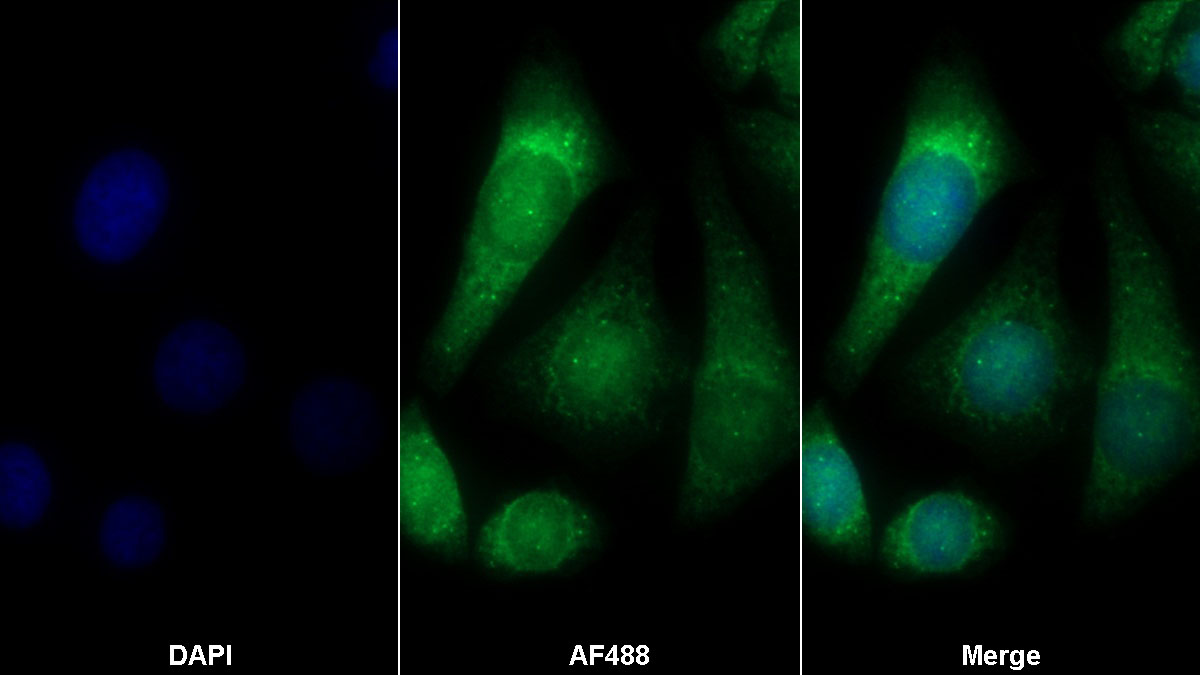 Polyclonal Antibody to Cyclophilin B (CYPB)