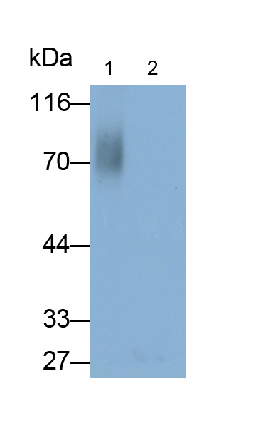 Polyclonal Antibody to Anti-Mullerian Hormone (AMH)