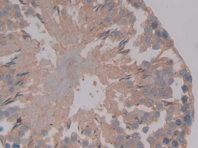 Polyclonal Antibody to Anti-Mullerian Hormone (AMH)