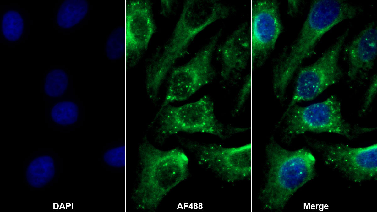 Polyclonal Antibody to Anti-Mullerian Hormone (AMH)