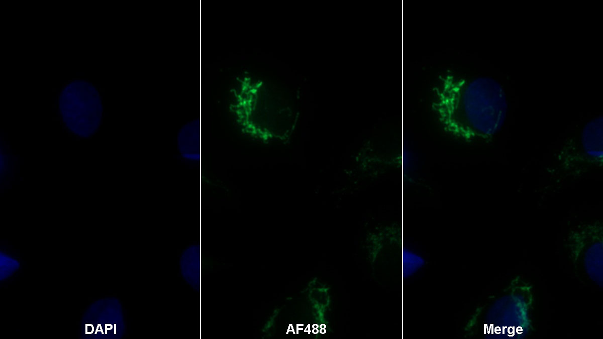 Polyclonal Antibody to Protease, Serine 1 (PRSS1)