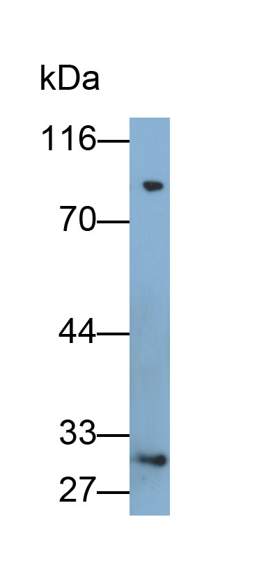 Polyclonal Antibody to Protease, Serine 1 (PRSS1)