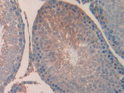 Polyclonal Antibody to Urocortin (UCN)