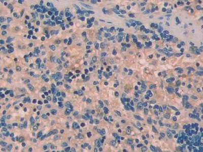 Polyclonal Antibody to Urocortin (UCN)